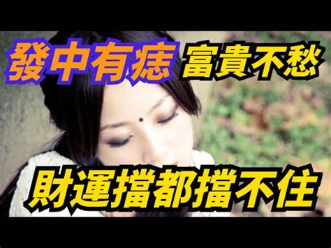 頭髮裡有痣|看看自己有嗎？痣長在「這4個位置」非富即貴超好命